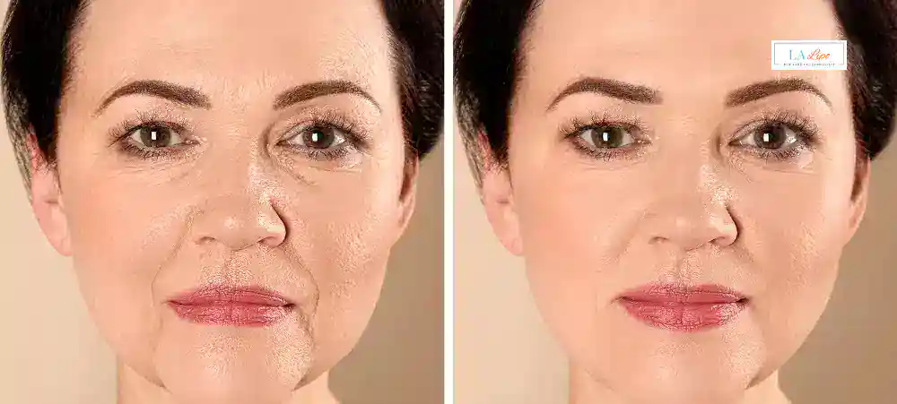 Why Aren’t My Skincare Products Making My Sagging Skin Look Firmer Lewes?